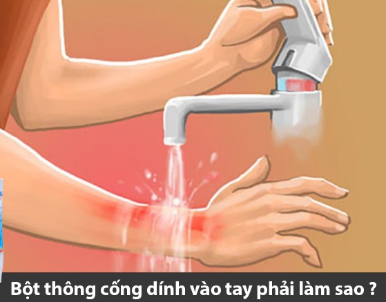 Cách xử lý khi bị bỏng do chất thông cống